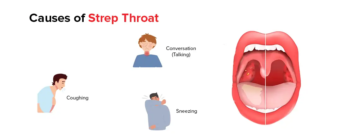 Causes of Strep Throat